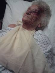 82-year-old woman who was attacked and robbed for her pension book 