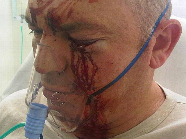 Brutal: Dave Reynolds was severely beaten on his lunch break