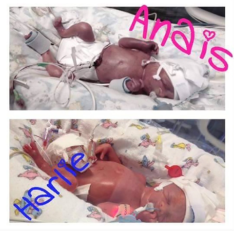 Anais and Harlie at birth