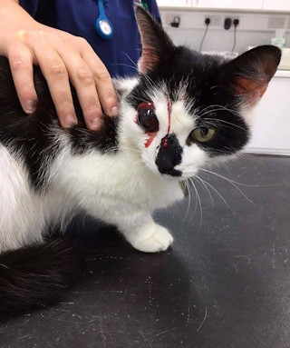 Macy underwent an operation but her eye couldn't be saved.