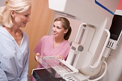 NHS England is calling for women to come forward for breast screening when invited